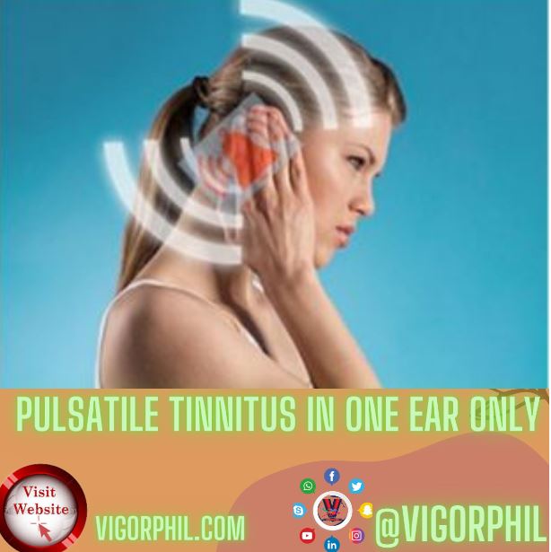 Pulsatile Tinnitus In One Ear Only