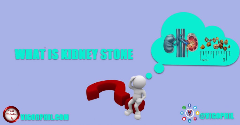What Is Kidney Stone