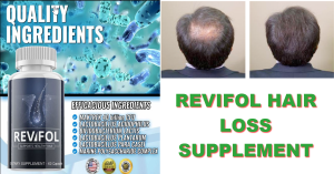 revifol hair loss