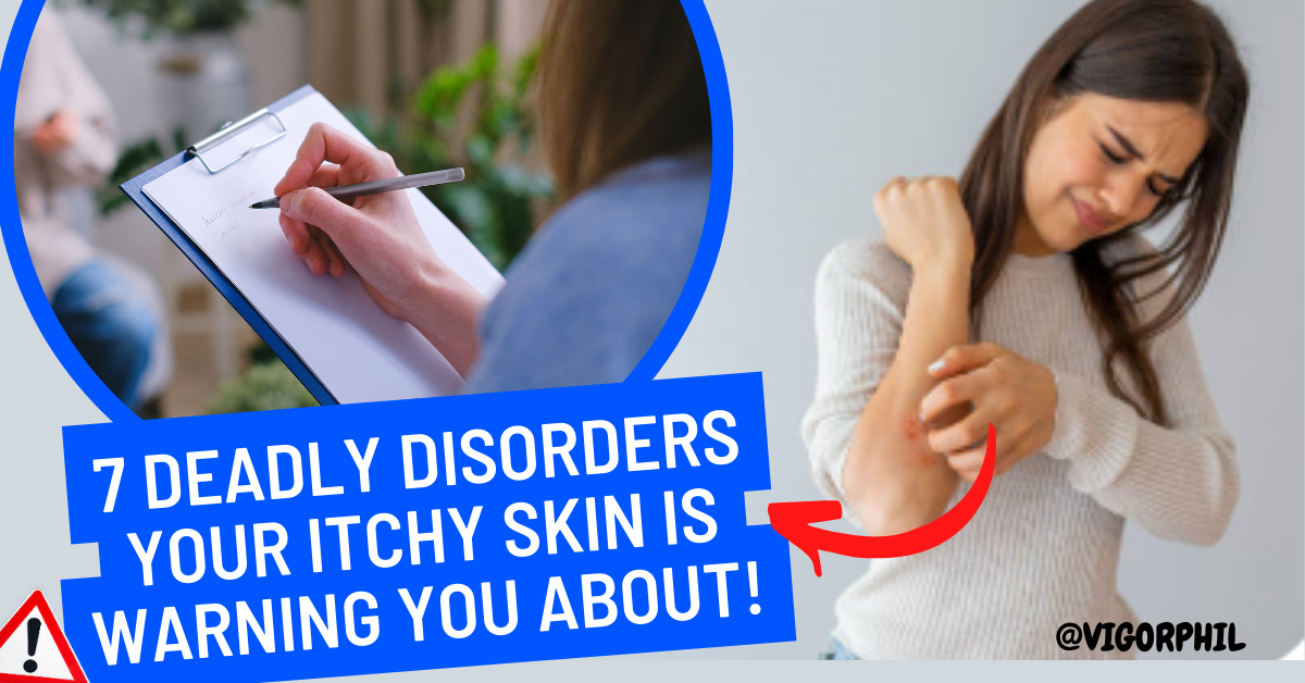 what causes itching skin without rash
