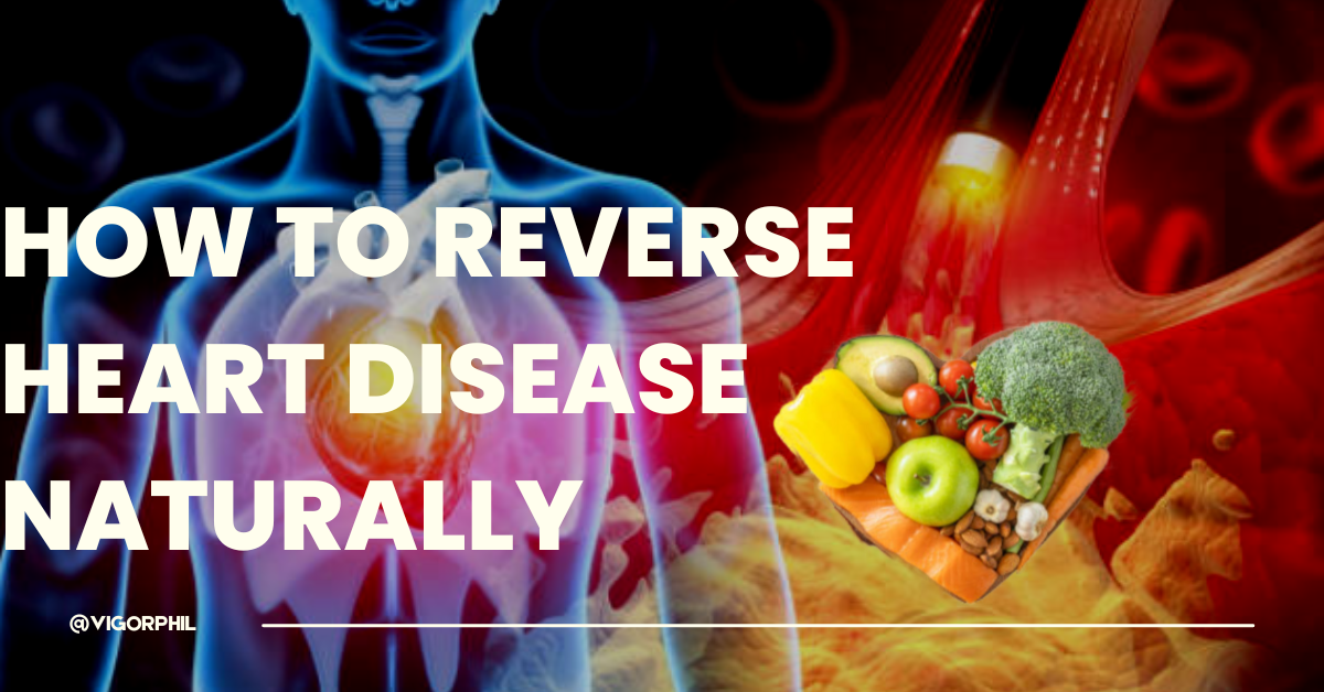 HOW TO REVERSE HEART DISEASE NATURALLY