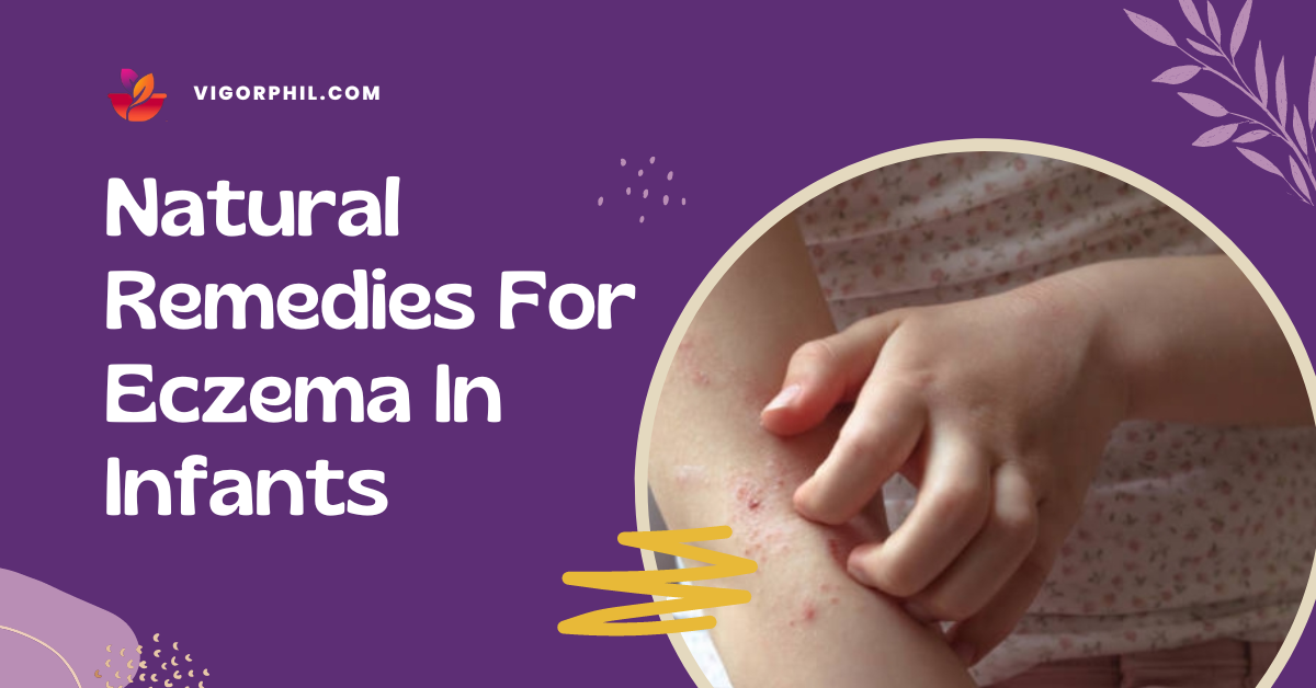 Natural remedies for eczema in infants