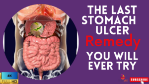 Natural remedies for stomach ulcer