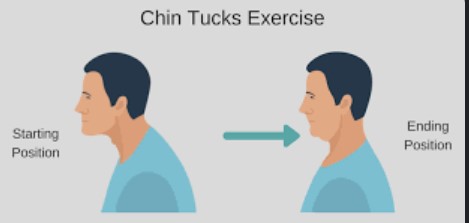Chin Tucks
How To Fix Bad Posture When Sitting